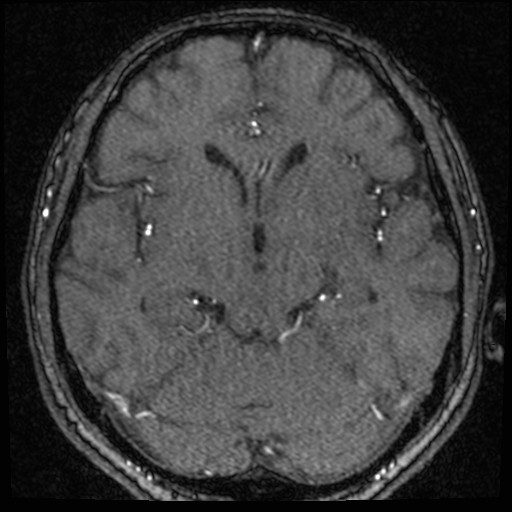 Click on the Serie image to view the images of VILLANUEVA, WILLIAM A.